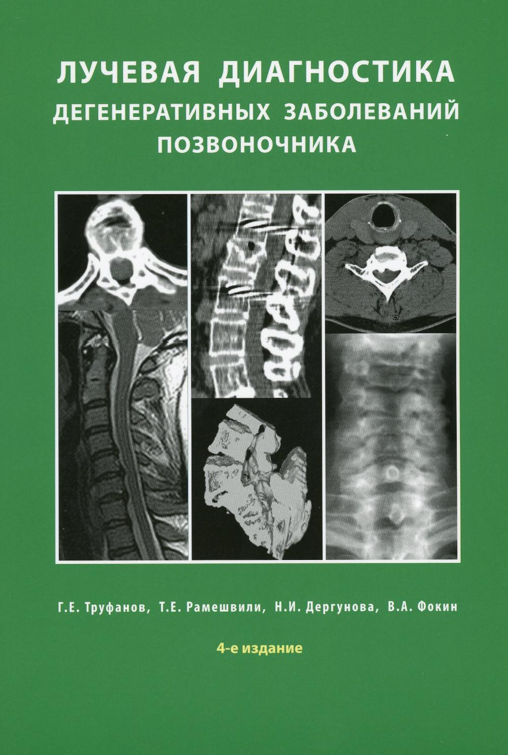 Лучевая диагностика дегенеративных заболеваний позвоночника. 4-е изд