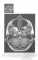 Норма КТ-и МРТ-изображений головного мозга и позвоночника: атлас изображений. 4-е изд