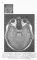 Норма КТ-и МРТ-изображений головного мозга и позвоночника: атлас изображений. 4-е изд