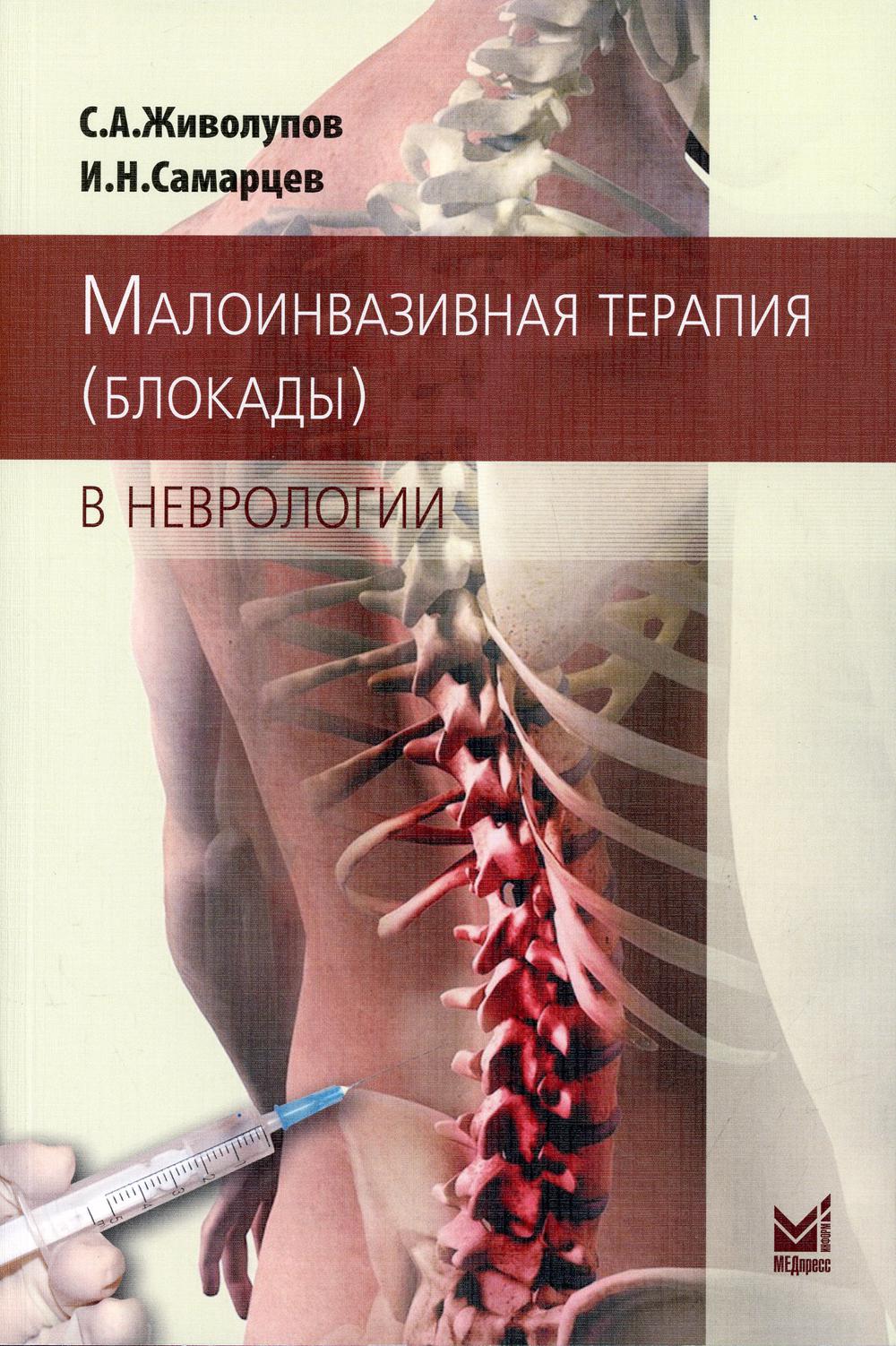 Малоинвазивная терапия (блокады) в неврологии. 4-е изд