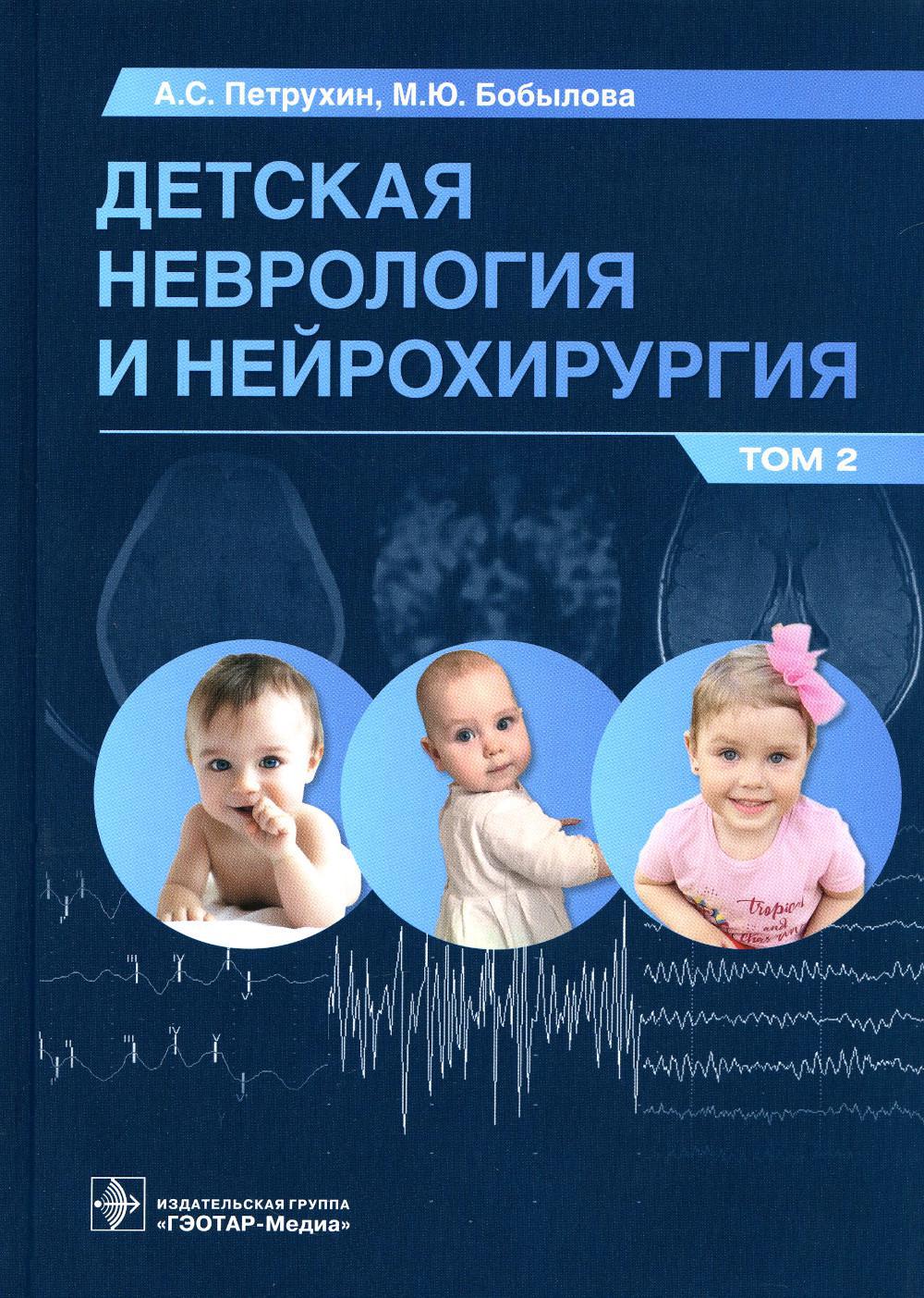 Детская неврология и нейрохирургия. В 2 т. Т. 2: Учебник