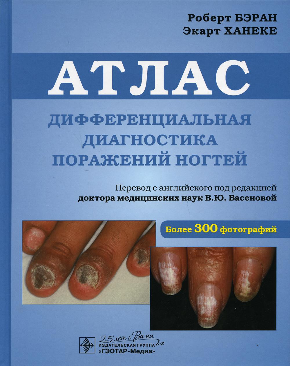 Дифференциальная диагностика поражений ногтей: атлас