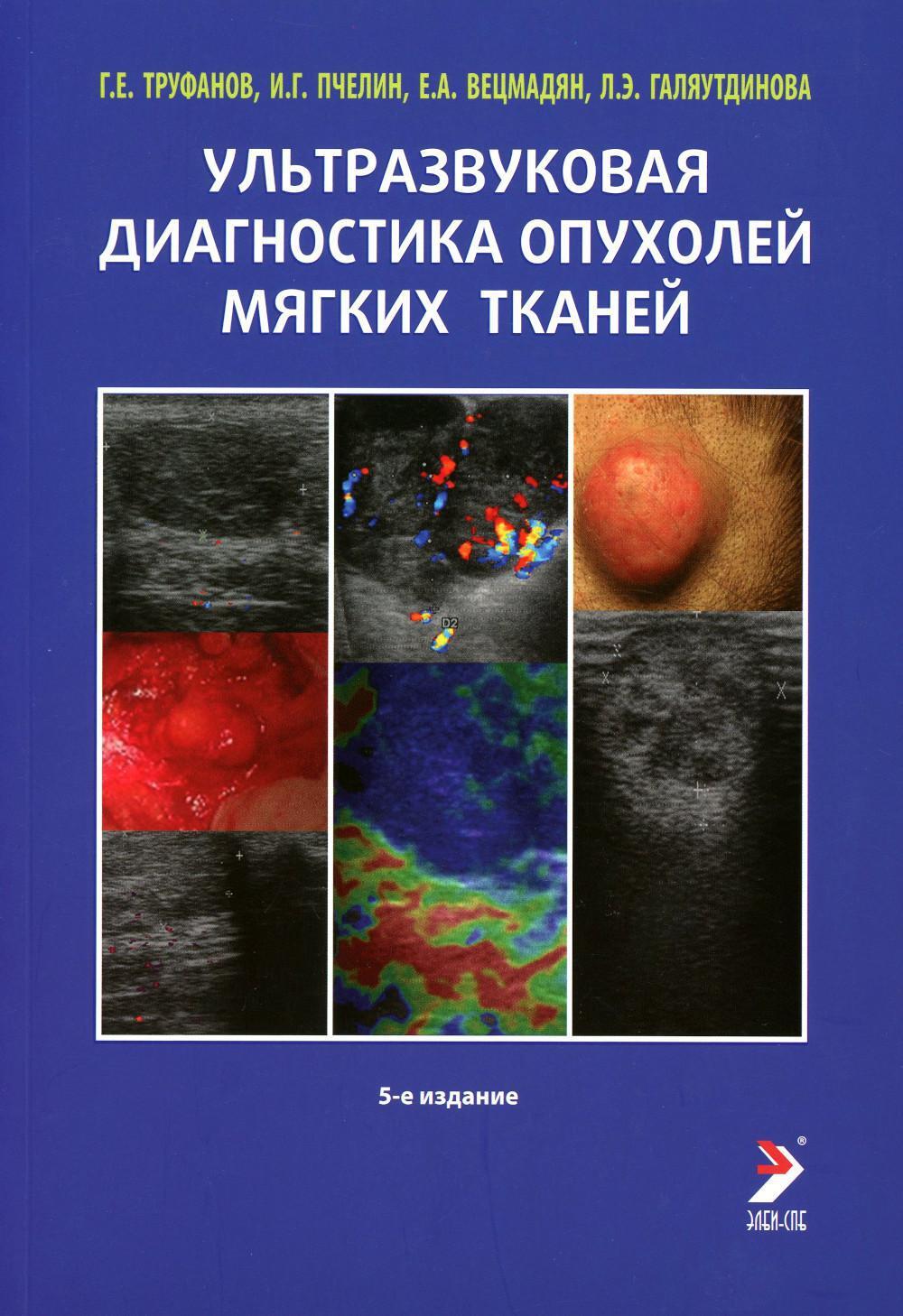 Ультразвуковая диагностика опухолей мягких тканей. 6-е изд