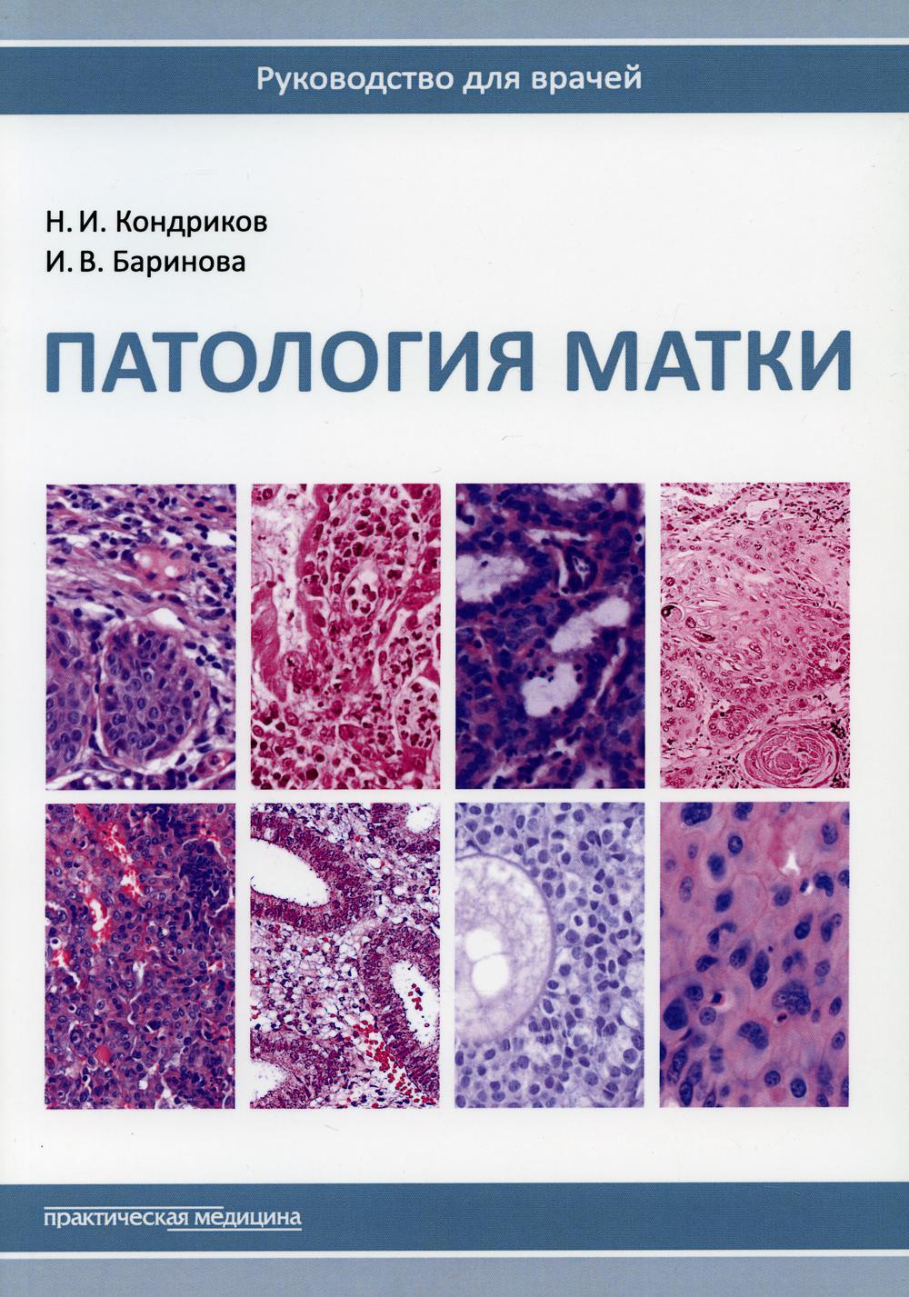 Патология матки. Руководство для врачей. 2-е изд