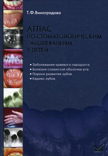 Атлас по стоматологическим заболеваниям у детей: учебное пособие. 2-е изд. + CD