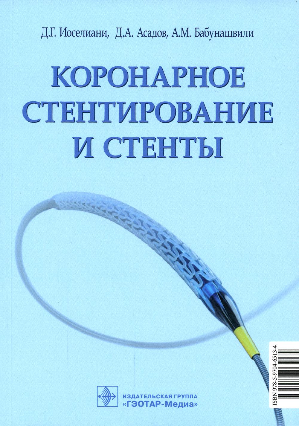 Коронарное стентирование и стенты