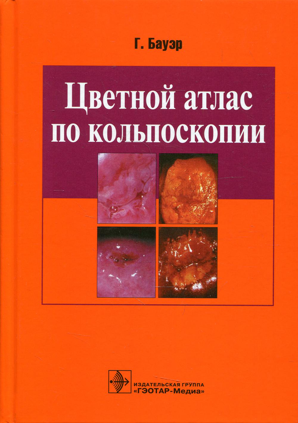 Цветной атлас по кольпоскопии