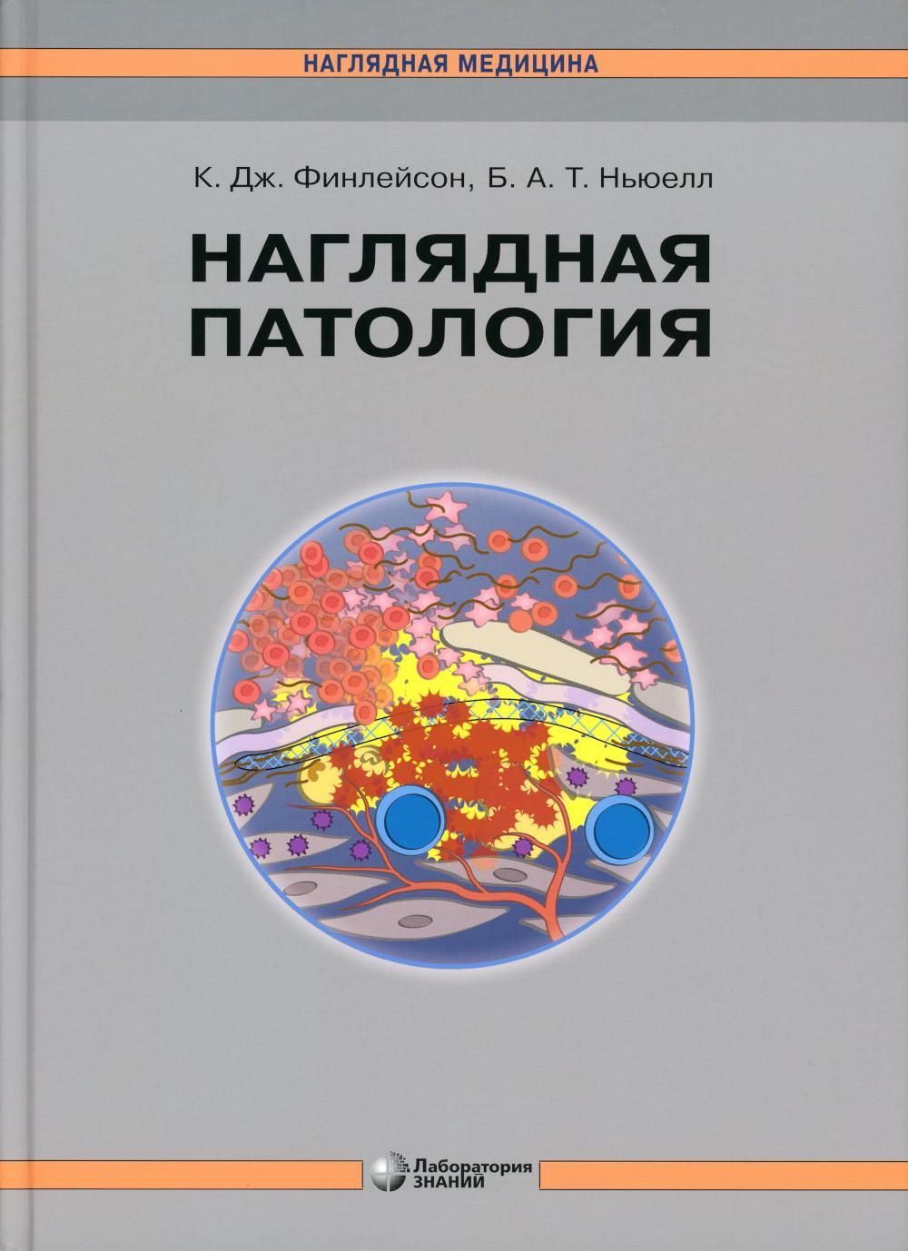 Наглядная патология. 2-е изд