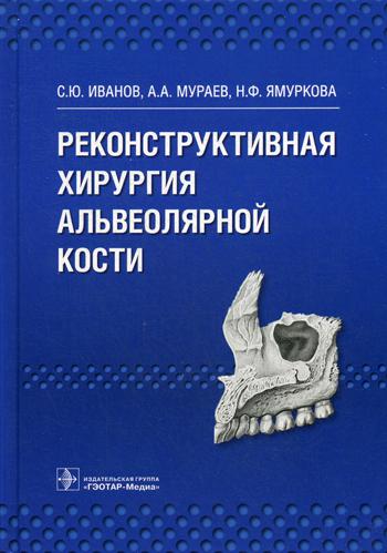 Реконструктивная хирургия альвеолярной кости