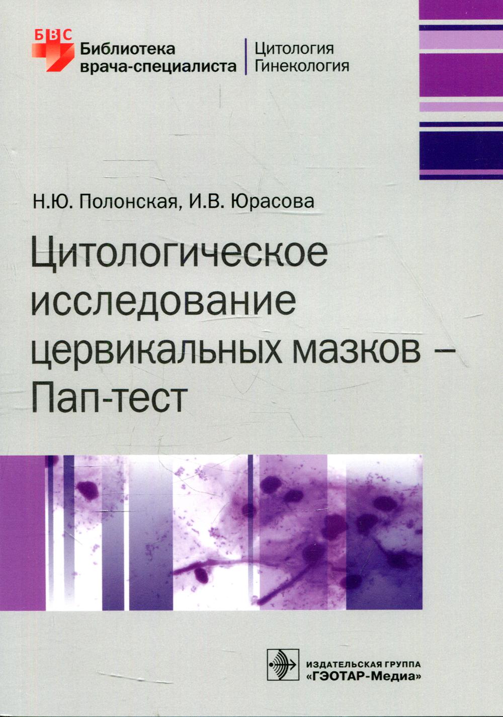 Цитологическое исследование цервикальных мазков - Пап-тест