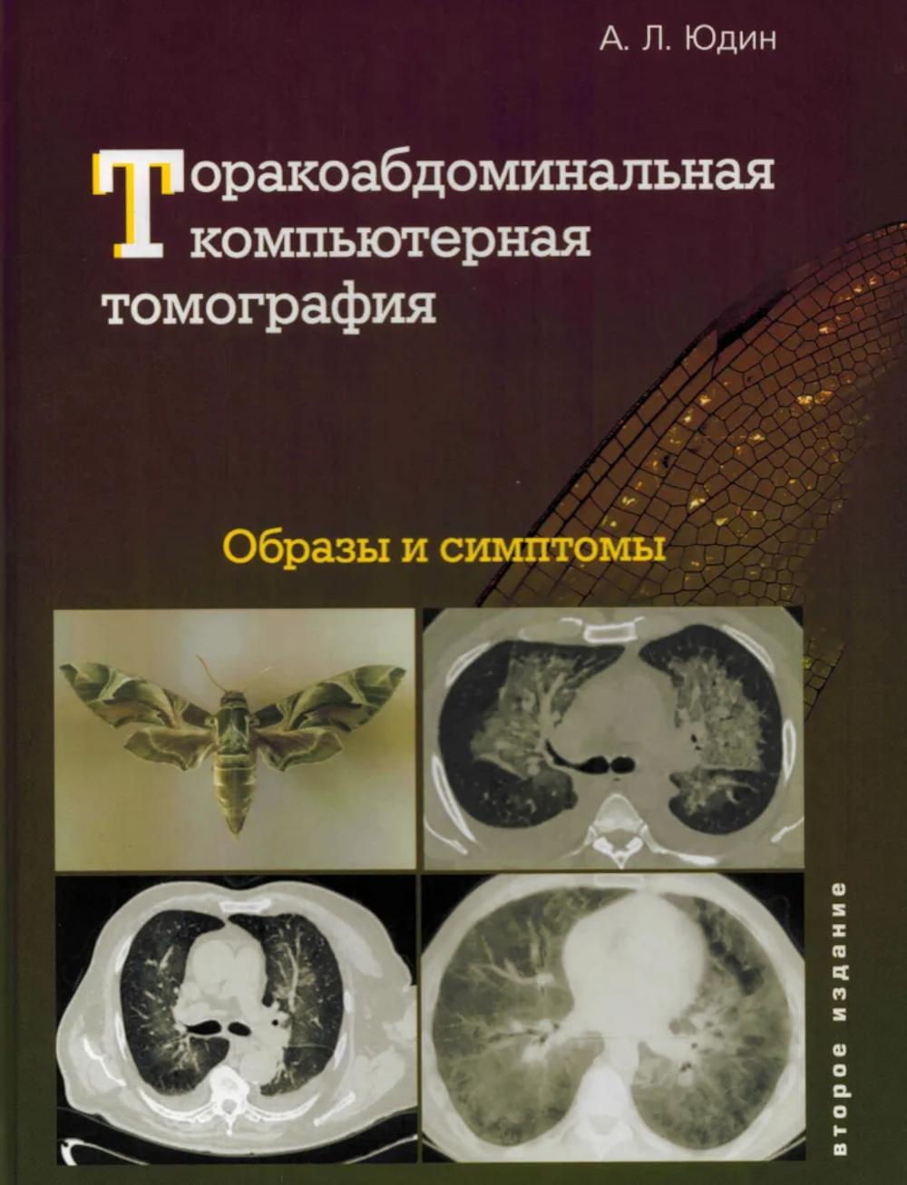Торакоабдоминальная компьютерная томография. Образы и симптомы