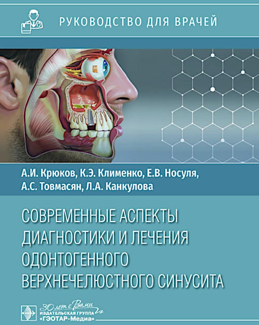 Современные аспекты диагностики и лечения одонтогенного верхнечелюстного синусита: руководство для врачей