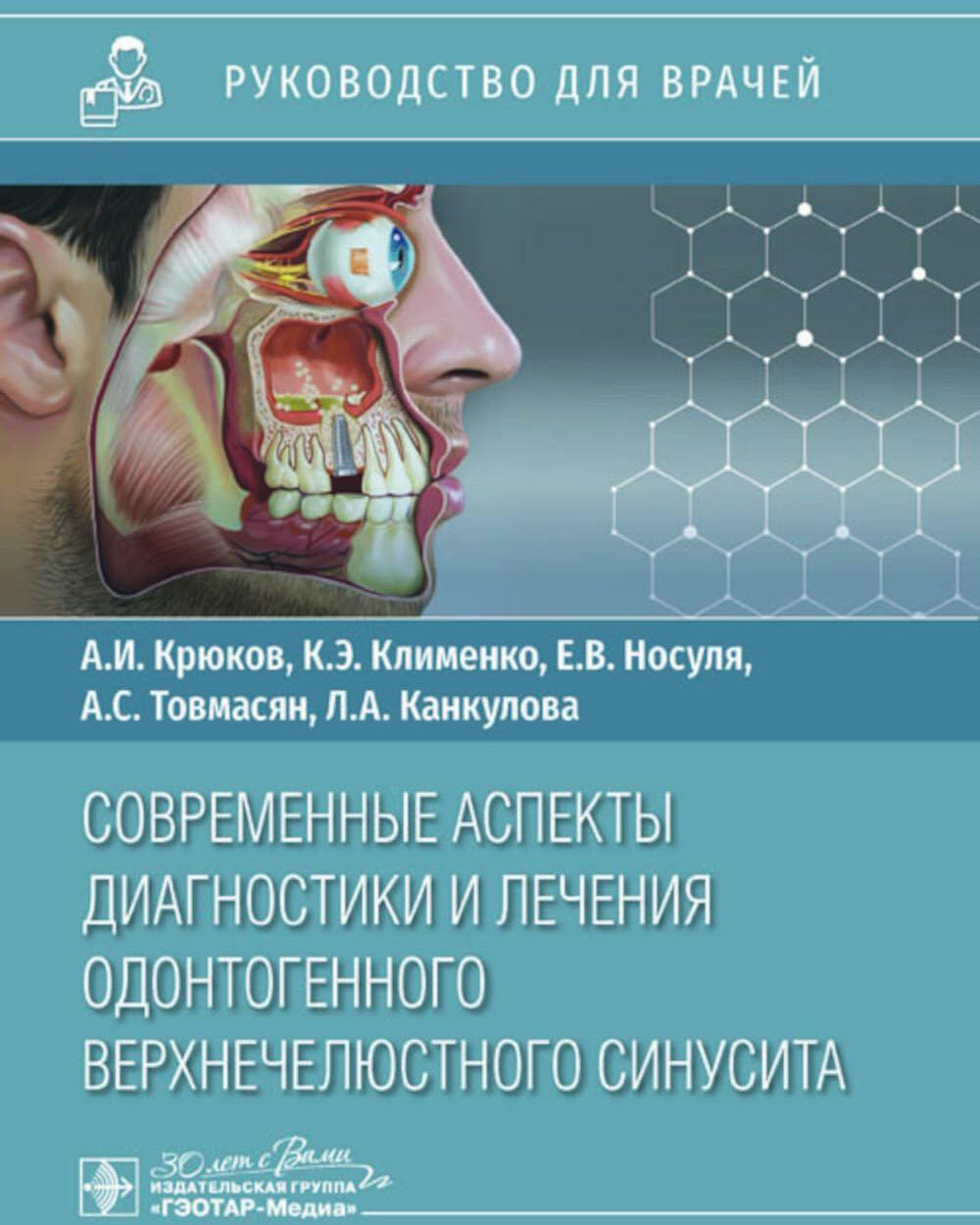 Современные аспекты диагностики и лечения одонтогенного верхнечелюстного синусита: руководство для врачей