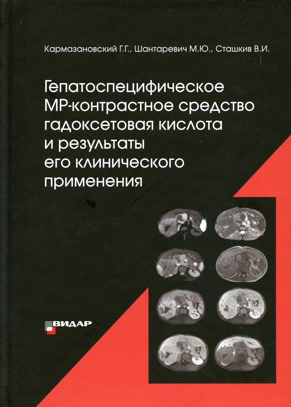 Гепатоспецифическое МР-контрастное средство «гадоксетовая кислота» и результаты его клинического применения"