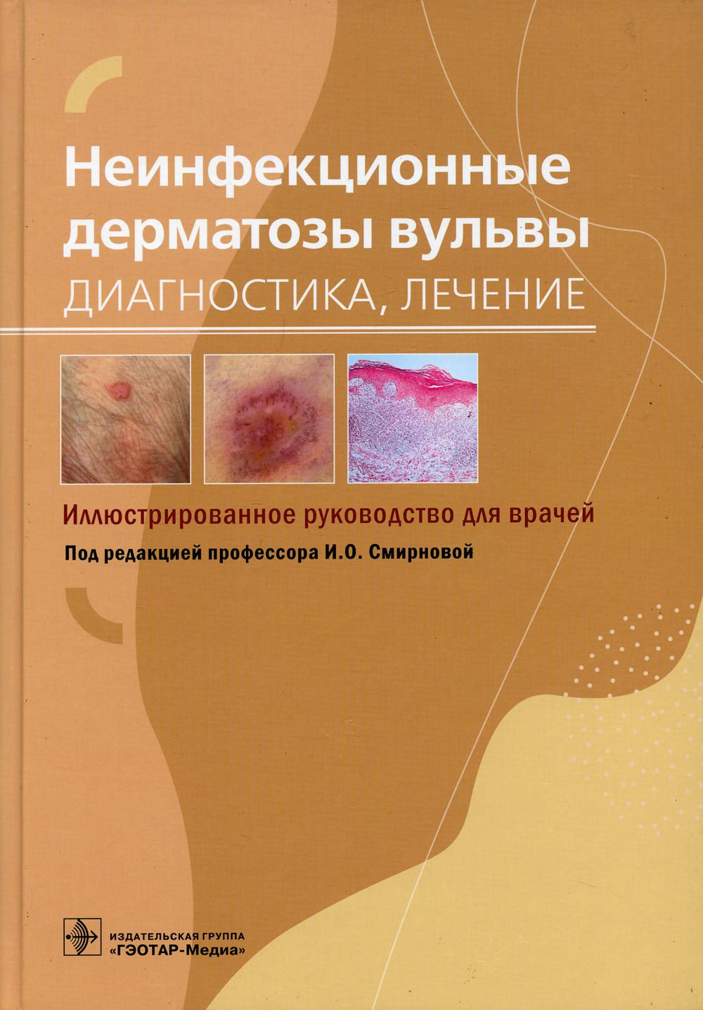 Неинфекционные дерматозы вульвы: диагностика, лечение: иллюстрированное руководство для врачей