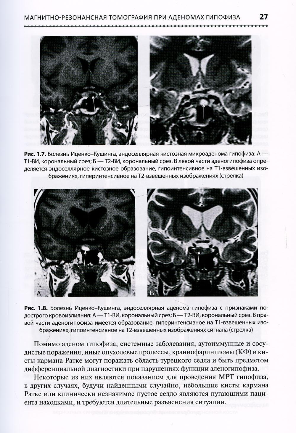 Основы клинической нейроэндокринологии