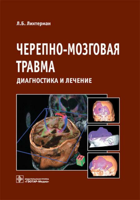 Черепно-мозговая травма. Диагностика и лечение