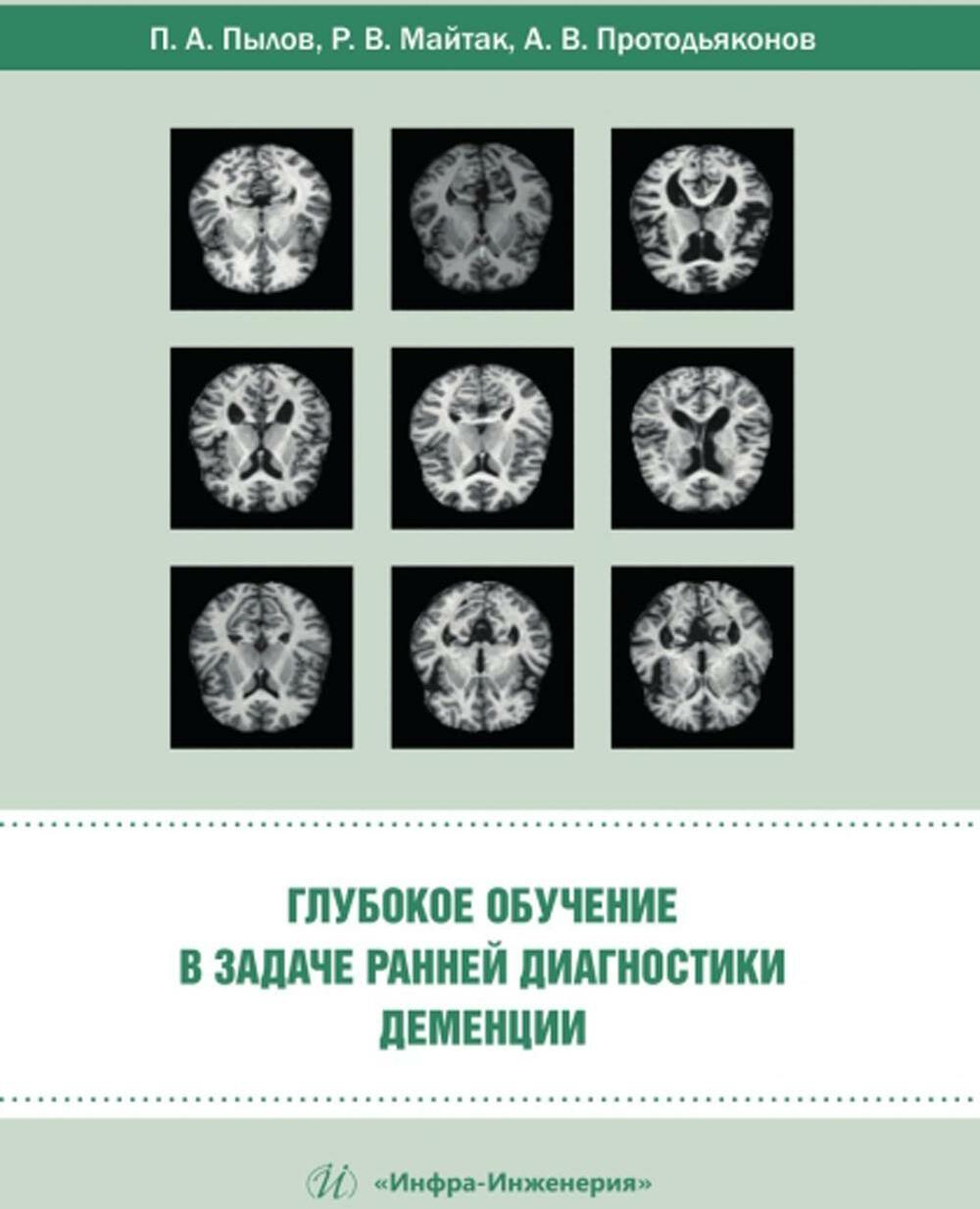 Глубокое обучение в задаче ранней диагностики деменции: монография