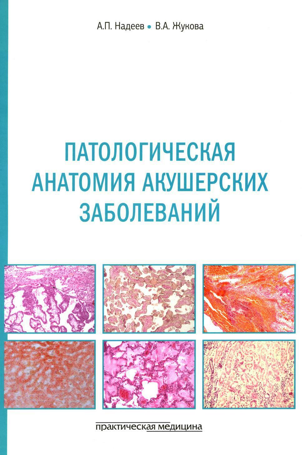 Патологическая анатомия акушерских заболеваний