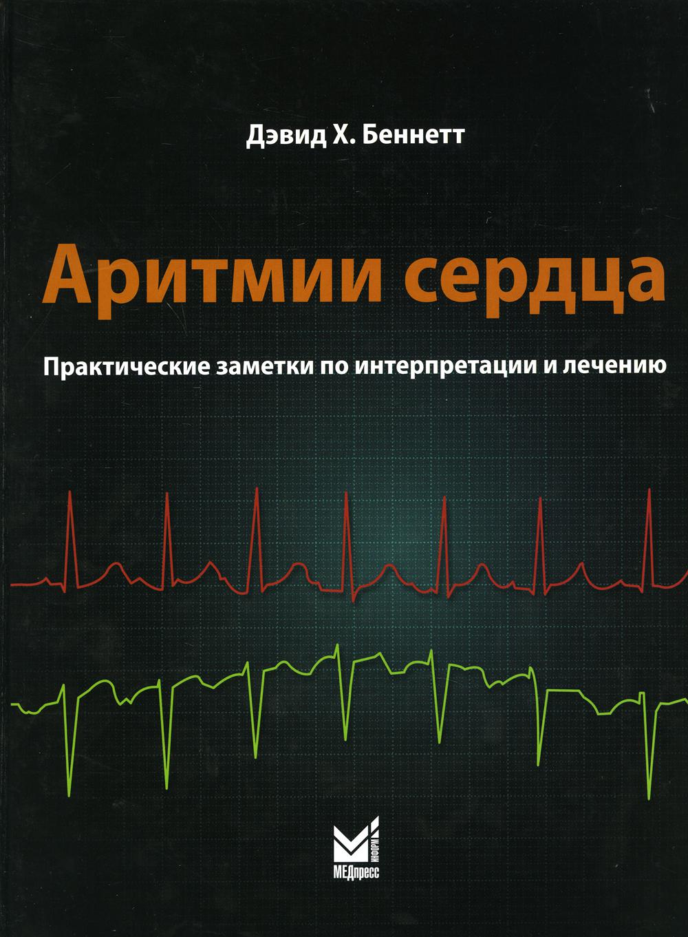 Аритмии сердца. Практические заметки по интерпретации и лечению. 2-е изд