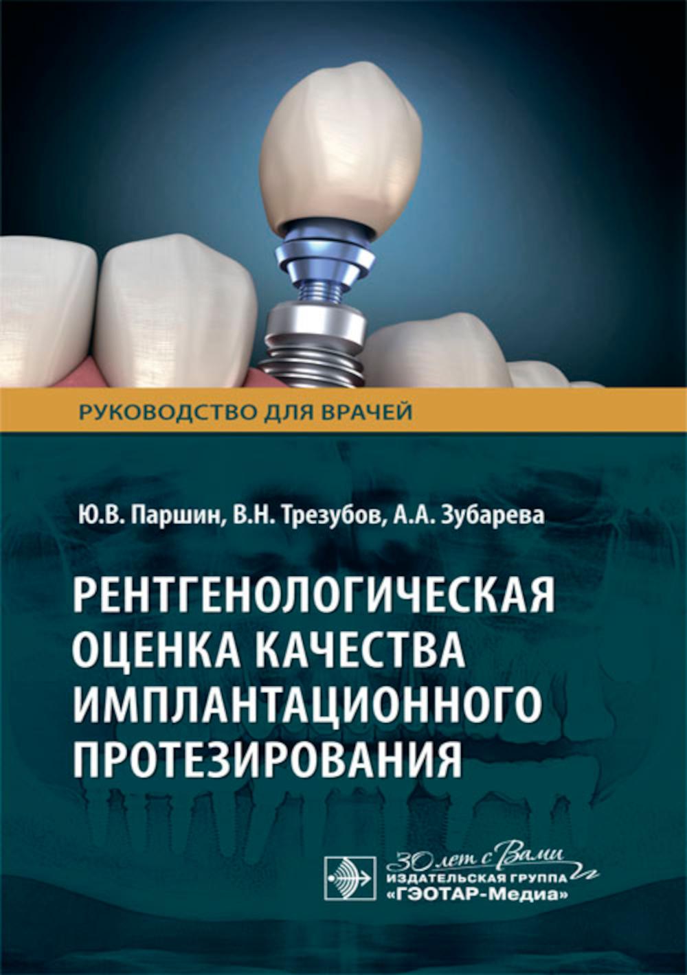 Рентгенологическая оценка качества имплантационного протезирования: руководство для врачей