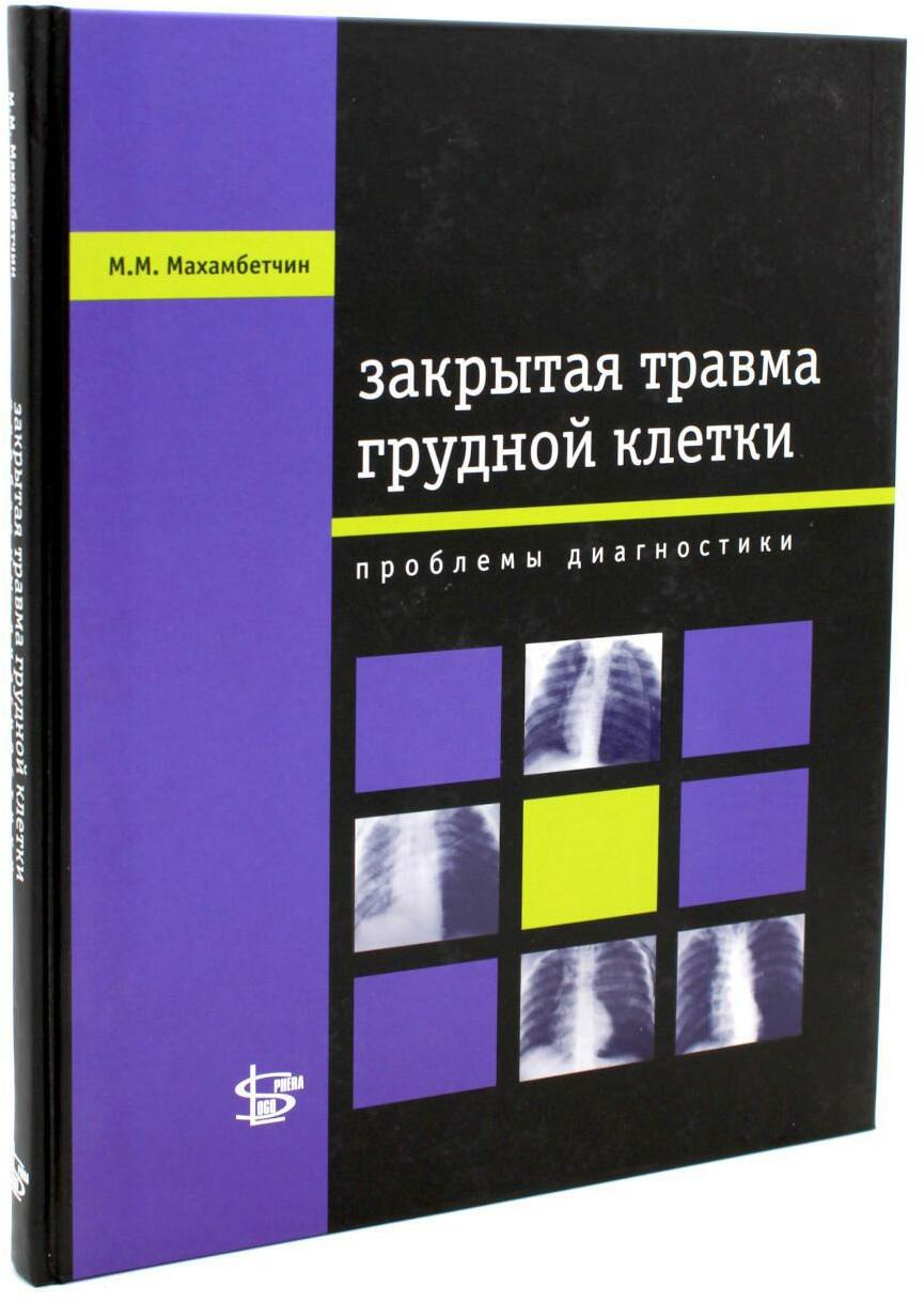 Закрытая травма грудной клетки: проблемы диагностики