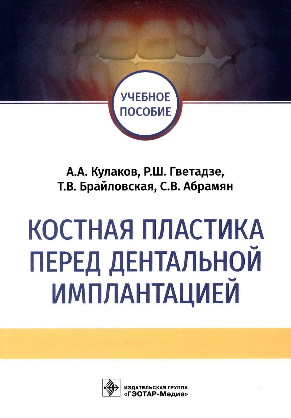 Костная пластика перед дентальной имплантацией: Учебное пособие