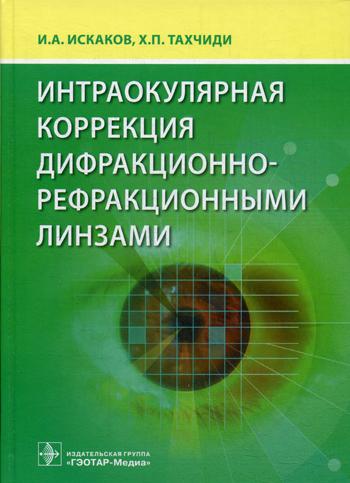 Интраокулярная коррекция дифракционно-рефракционными линзами