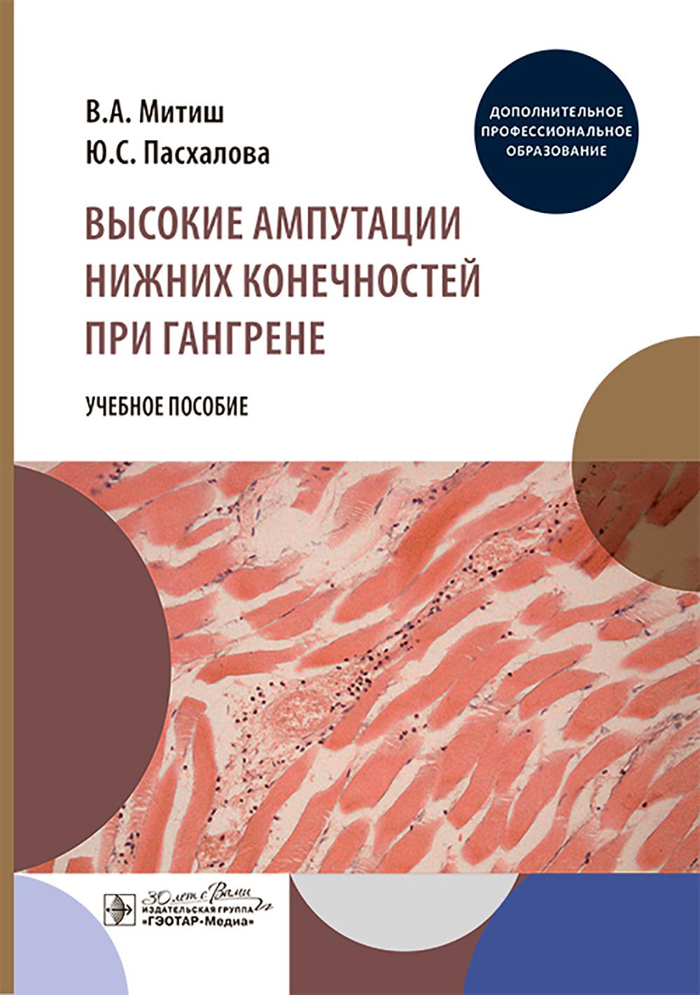 Высокие ампутации нижних конечностей при гангрене: Учебное пособие
