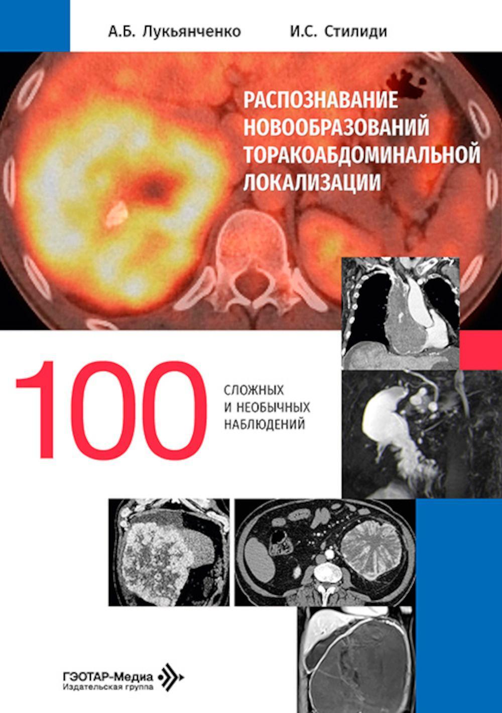 Распознавание новообразований торакоабдоминальной локализации: 100 сложных и необычных наблюдений
