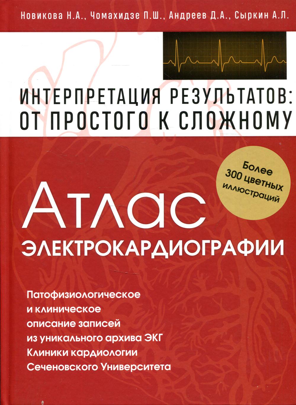 Атлас электрокардиографии. Интерпретация результатов: от простого к сложному