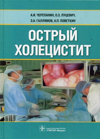 Острый холецистит