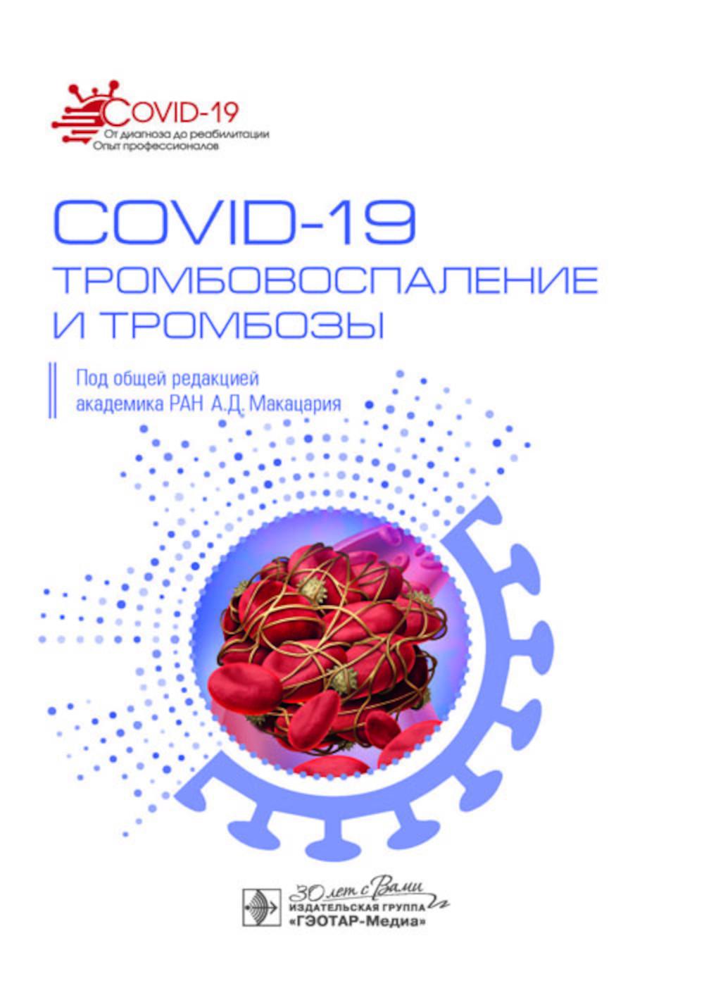 COVID-19, тромбовоспаление и тромбозы: руководство для врачей