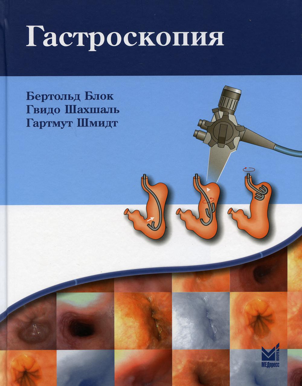 Гастроскопия. 4-е изд