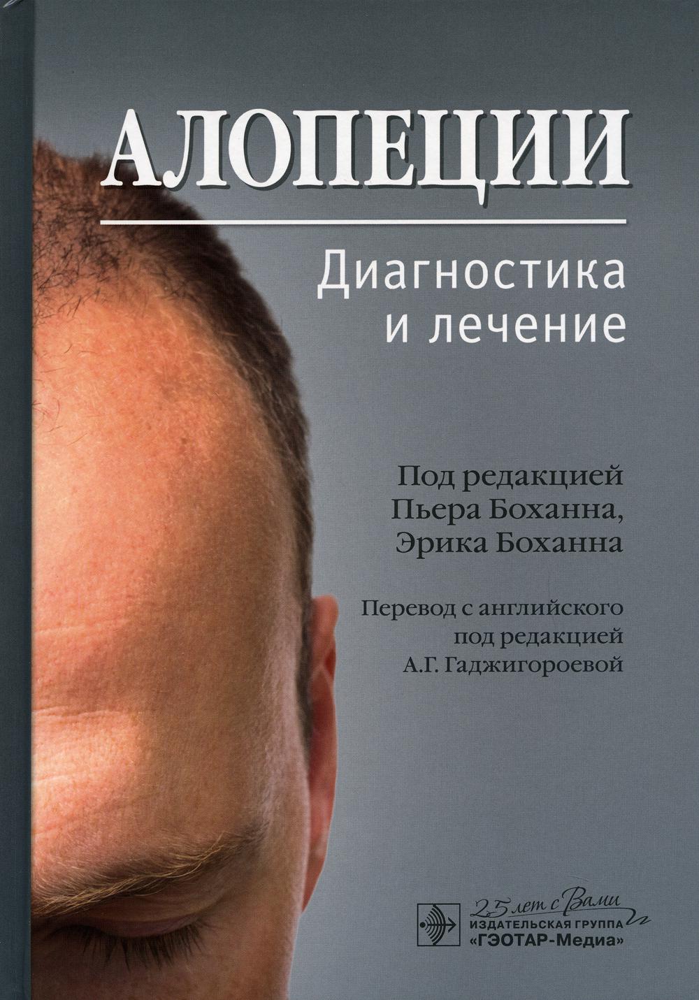 Алопеции. Диагностика и лечение