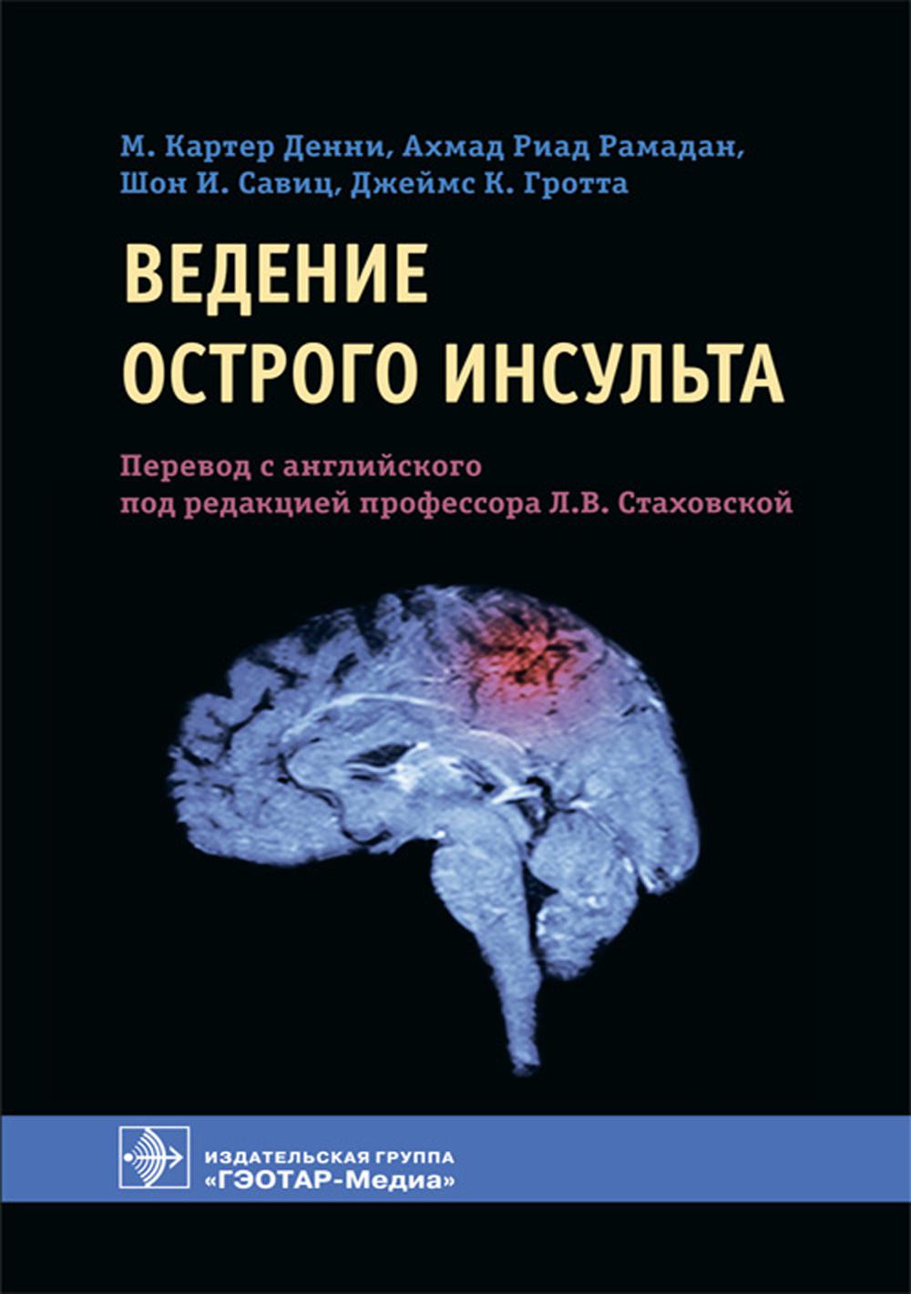 Ведение острого инсульта