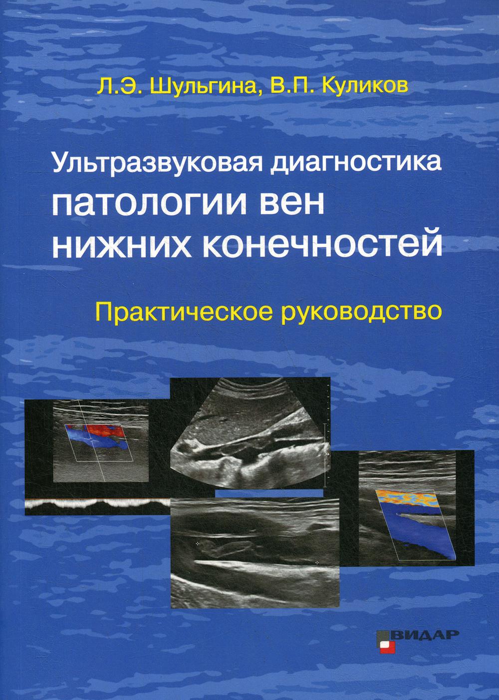 Ультразвуковая диагностика патологии вен нижних конечностей: практическое руководство