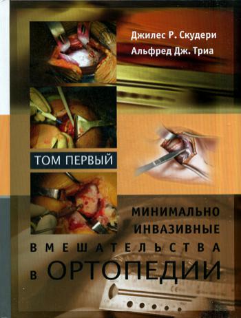 Минимально инвазивные вмешательства в ортопедии: В 2 т. Т. 1