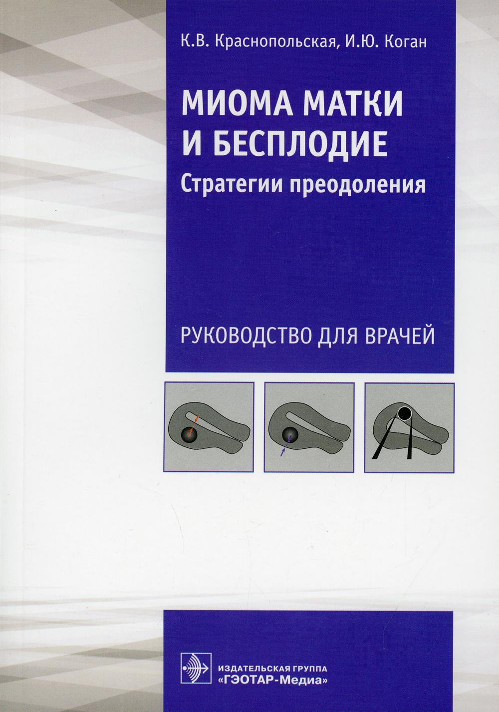 Миома матки и бесплодие: стратегии преодоления: руководство для врачей