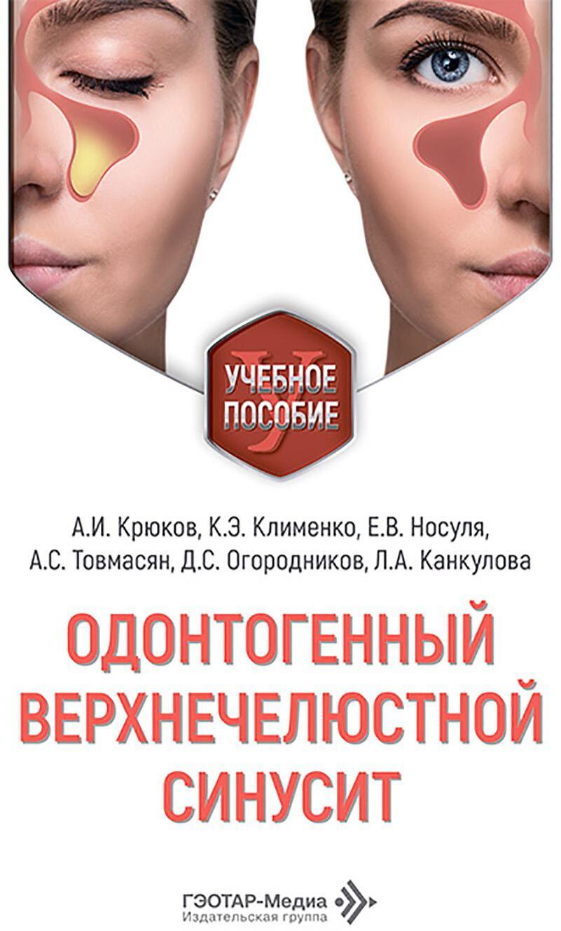 Одонтогенный верхнечелюстной синусит : учебное пособие