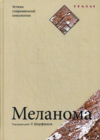 Меланома. Успехи современной онкологии