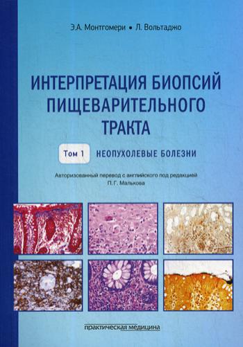Интерпретация биопсий пищеварительного тракта. Т. 1: Неопухолевые болезни