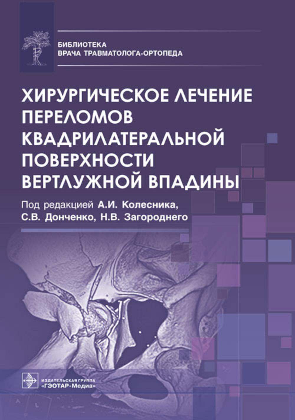 Хирургическое лечение переломов квадрилатеральной поверхности вертлужной впадины