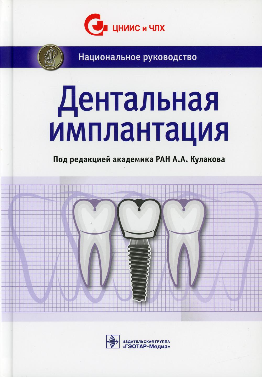 Дентальная имплантация: национальное руководство