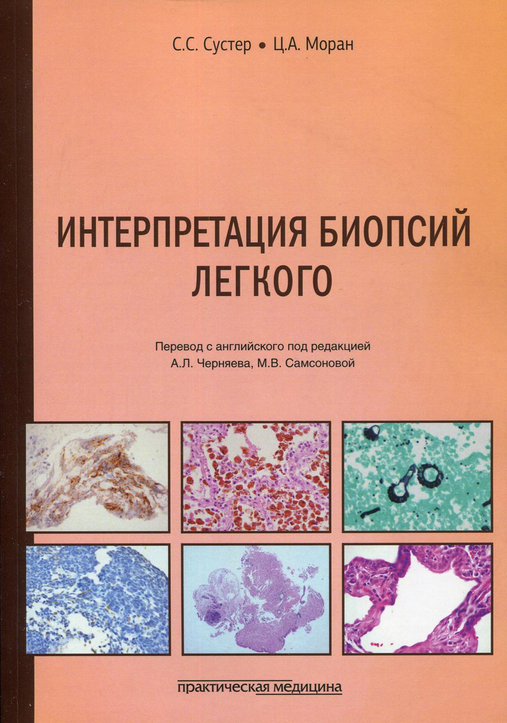 Интерпретация биопсий легкого