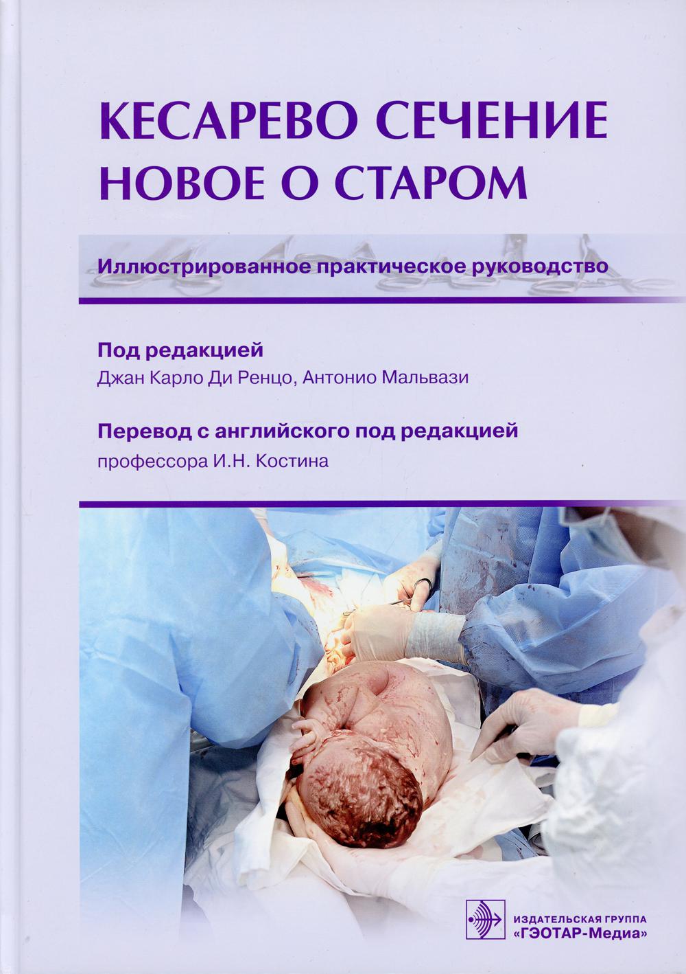 Книга «Кесарево сечение. Новое о старом. Иллюстрированное практическое  руководство» (Под ред. Д.К. Ди Ренцо, Мальвази А.) — купить с доставкой по  Москве и России