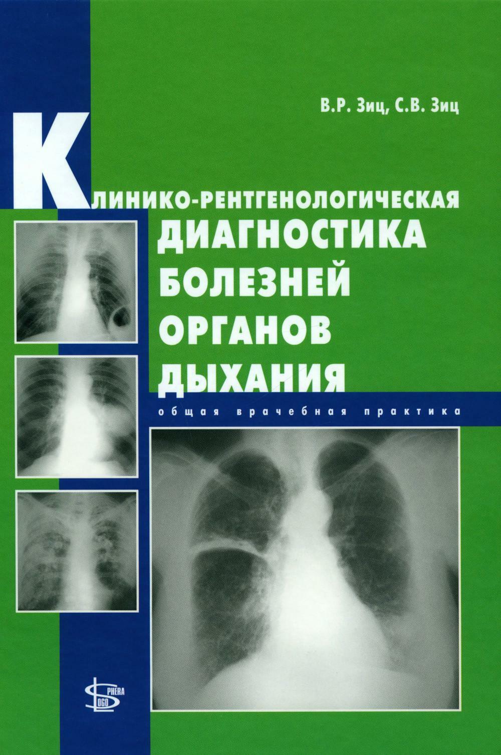 Клинико-рентгенологическая диагностика болезней органов дыхания: общая врачебная практика