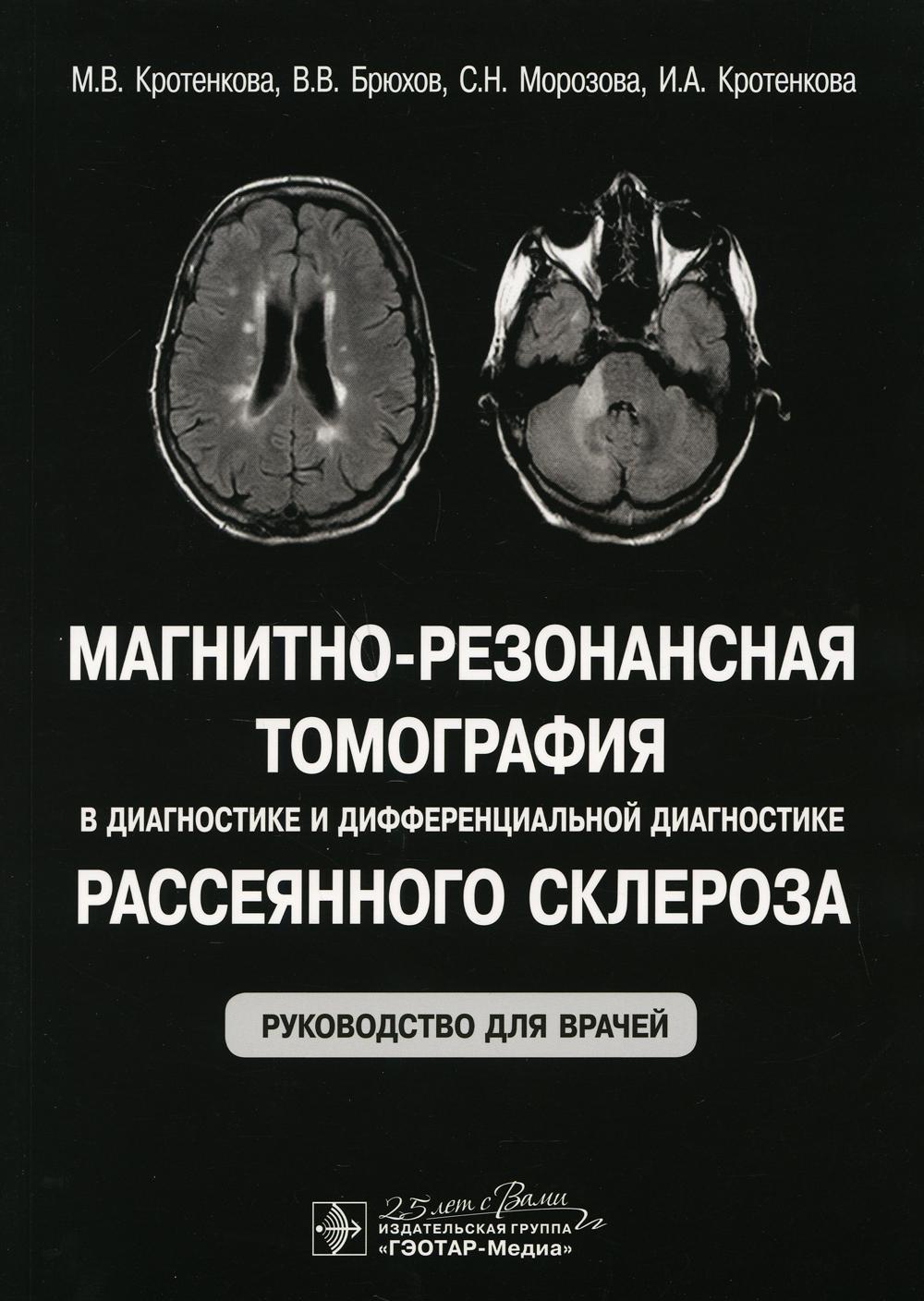 Магнитно-резонансная томография в диагностике и дифференциальной диагностике рассеянного склероза: руководство для врачей