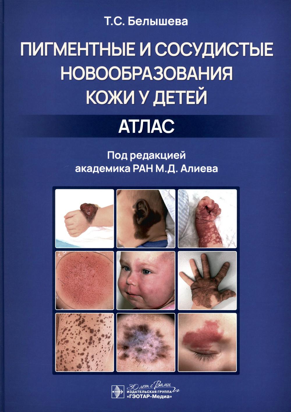 Пигментные и сосудистые новообразования кожи у детей. Атлас