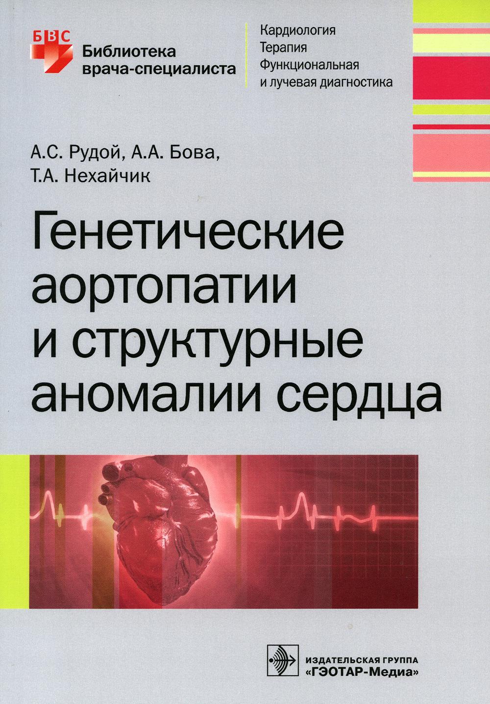 Генетические аортопатии и структурные аномалии сердца